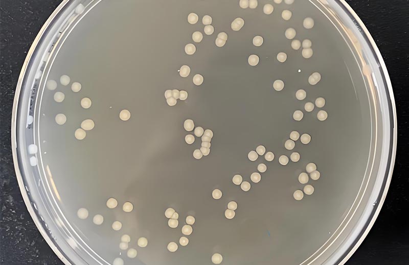 微生物菌落總數(shù)檢測為何需48小時(shí)培養(yǎng)？
